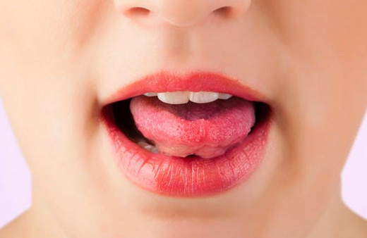 Damak yarasından kurtulmak için bu yöntemleri deneyin!