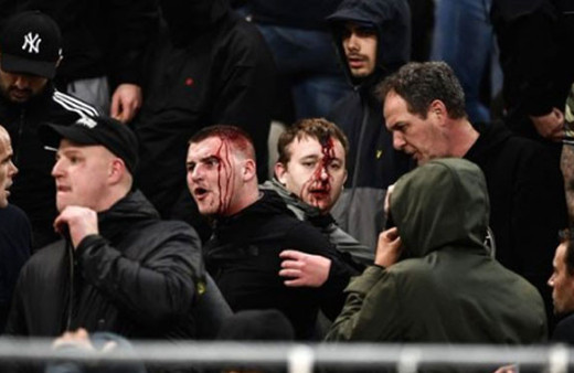 Dev maç öncesi ortalık karıştı tribünde kan döküldü!