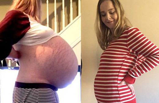 Hamile ve şişmanım sandı ama hastanede dumura uğradı