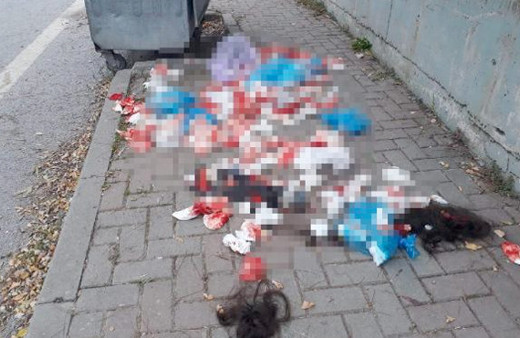 Kandıra'da kadın saçları ve kanlı bez paniği