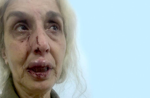 Sokak hayvanlarını beslediği için tekme tokat dövdüler