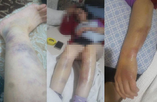 Bir kadın feryat ediyor! Boynumu kırdı dişlerimi döktü kurtarın beni...