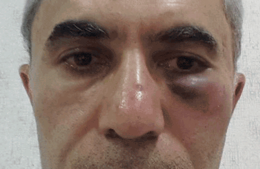 Sağlıkta şiddet! Gereksiz ameliyatta hekimler birbirlerini dövdü