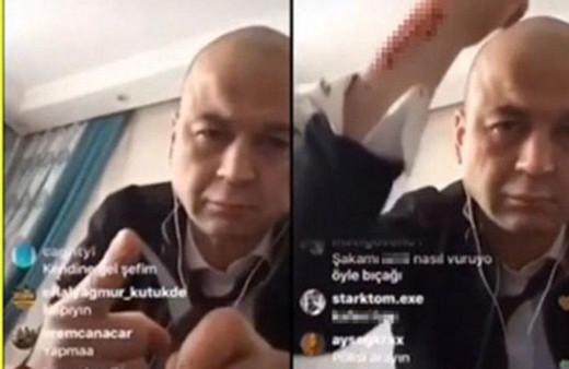 Masterchef Murat bu defa kendini kesti!