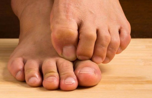 Ayak kokunuzdan hemen kurtulmak için bu yöntemi deneyin