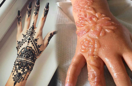 Kesinlikle yaptırmayın cilde inanılmaz zararları bulunuyor!