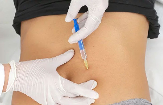 Uzmanlar, diyete bağlı kalamayanlar için 'mide botoksu' öneriyor