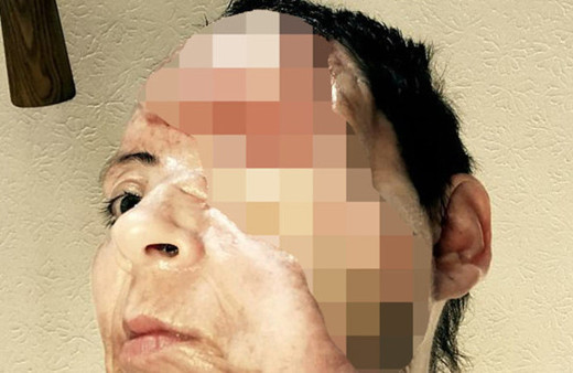 Yüzünde havai fişek patladı! Hayatı bir günde karardı