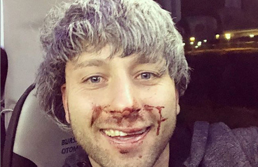 Survivor Taner Tarlacı kafayı sıyırmış fena dayak yedi bakın ne paylaştı