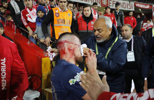 Kanlar içinde yerde kaldı! Yürekleri ağza getiren sakatlık