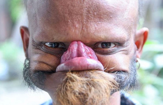 Diliyle alnını yalayan adam inanılmaz ama gerçek...