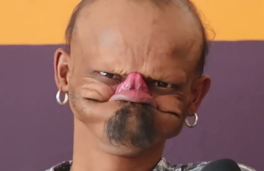 Alnını yalayan adam! Dili papuç kadar