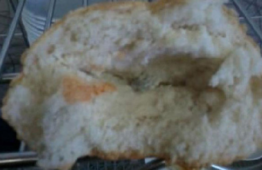 Ekmeğin içinden öyle bir şey çıktı ki yuttu ameliyatla çıkarılacak