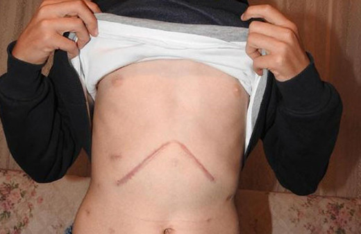 Çorum'da rehber öğretmen dehşeti! Ameliyatlı öğrenciyi bu hale soktu