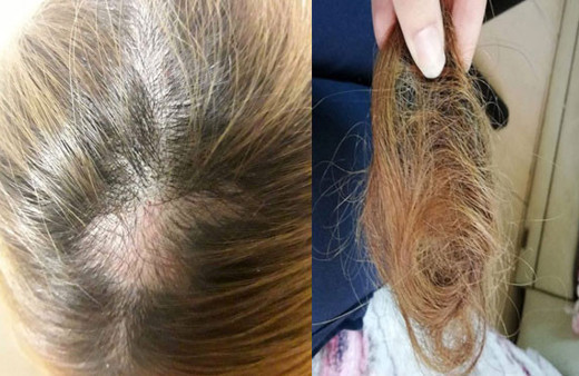 Ambulansta çirkin saldırı sağlık çalışanının saçlarını söktü