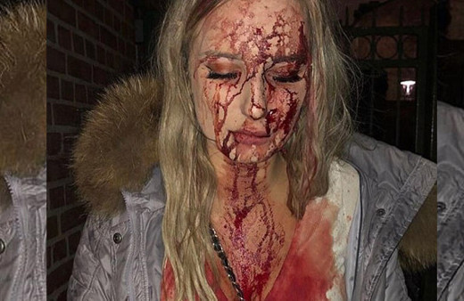 Bu hale getirdi gece kulübünde önce tacize uğradı sonra da...