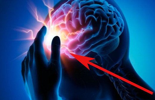 Epilepsi nöbetini herkes geçirebilir