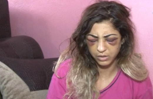 Kuma getirince kendisini terk eden eşini 30 dakika dövüp tanınmaz hale getirdi