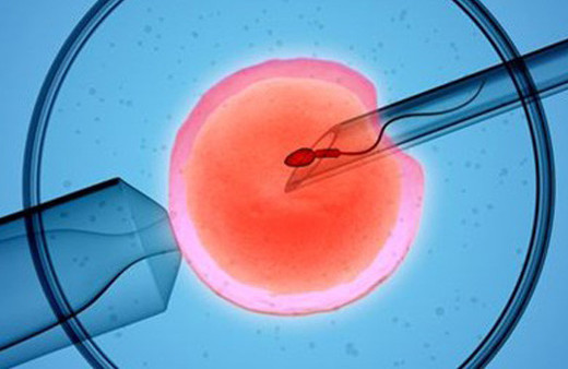 Genetik örnekleme yöntemi tüp bebek başarısızlıklarını azaltıyor