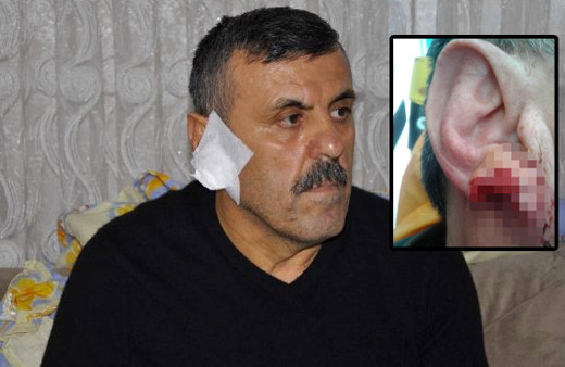 İnanılmaz olay kulağını ısırıp kopardı sonra tükürdü!