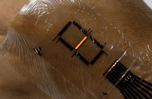 Hissedebilen yapay deri geliştiriliyor 