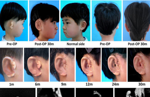 Çinliler sonunda bunu da yaptı !