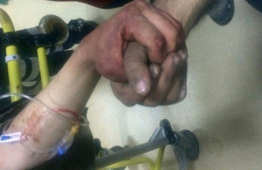 Bu kare sosyal medyayı salladı Afrin'de yaralanan askerlerimiz...