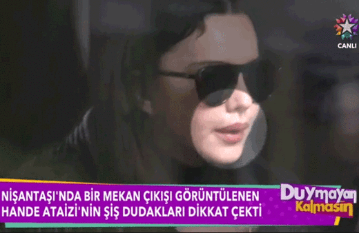 Boşanma Aşamasına Gelen Hande Ataizi, Kendini Estetiğe Verdi