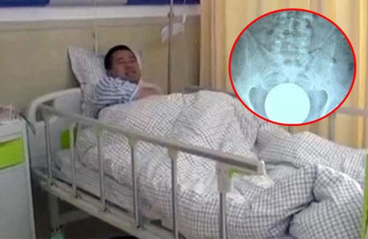 Eğlence için anüsüne öyle bir şey soktu ki hastanelik oldu!