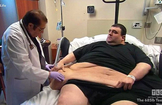 133 kilo vermişti! Milyonlarca kişi izliyordu sonu feci oldu