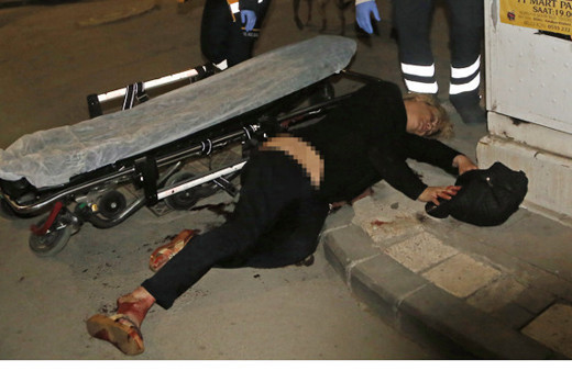 Adana'da sokakta yürüyen travestiye bıçaklı saldırı