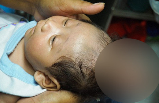 El kadar bebek böyle doğdu tıp dünyası hayrete düştü!