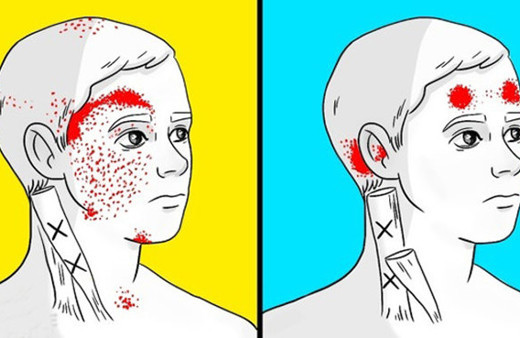 Baş ağrısı ve migreni tetikleyen besinler