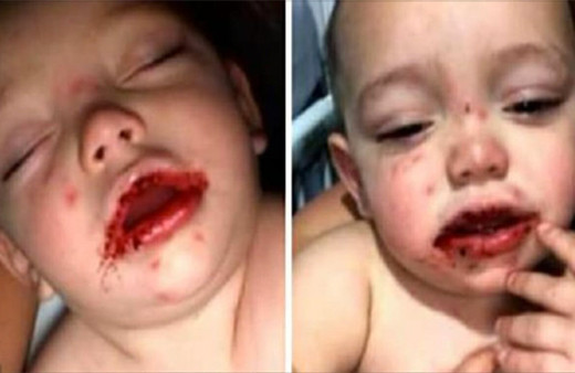 Çocuğunu bir anda bu halde buldu hastaneye koştu gerçekler acı!