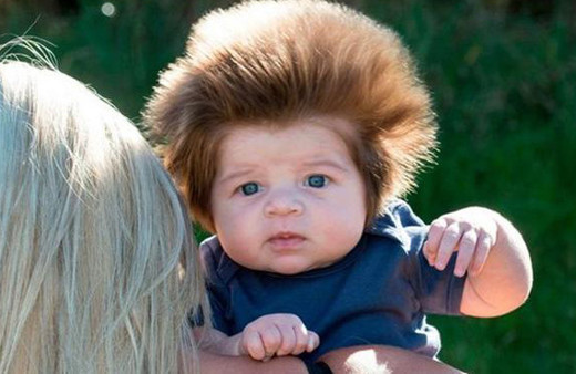 Saçlarıyla tanınmıştı işte şimdiki hali