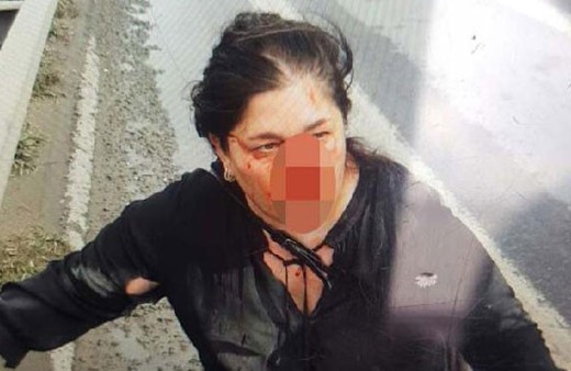 Bu da Uber sürücüsü dehşeti! Kadın yolcuyu dövüp yola attı