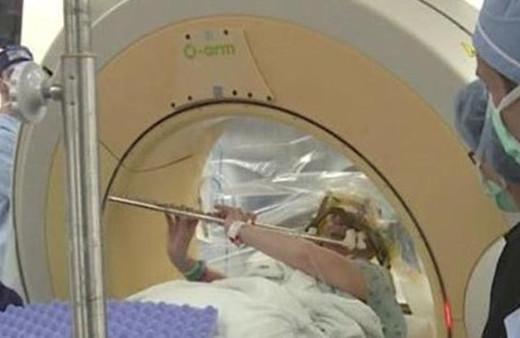 Beyin ameliyatında flüt çaldı