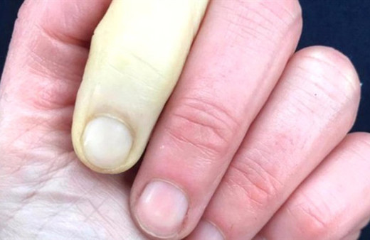 Ünlü sunucu elinin fotoğrafını paylaştı görenler şaştı