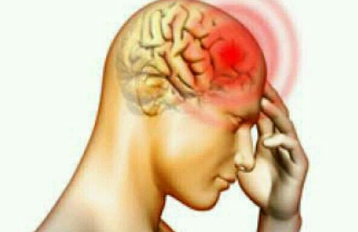 Ercan Yazgan'ı öldüren İskemik serebrovasküler hastalığı nedir belirtileri