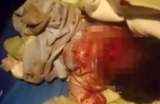 Yenidoğan bebeği sokağa bıraktı köpekler paramparça etti!