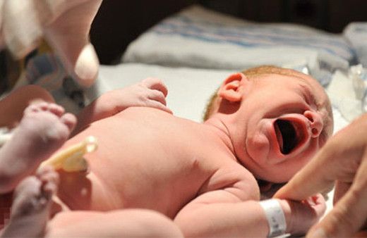 Doğum sonrası sünnet yararlı mıdır ?