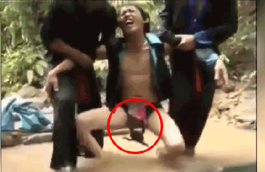 Dehşete düşüren anlar! Bir anda adamın cinsel organını ısırdı