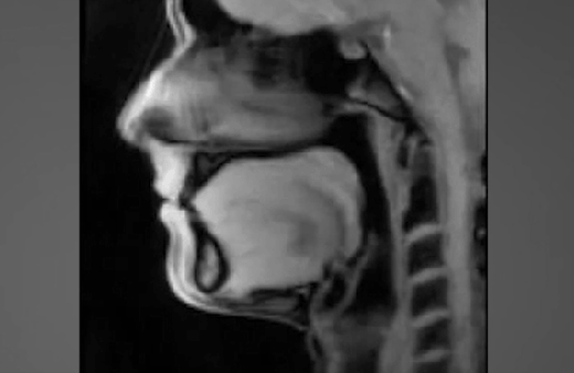 Konuşurken dilin hareketleri görenleri hayrete düşürüyor