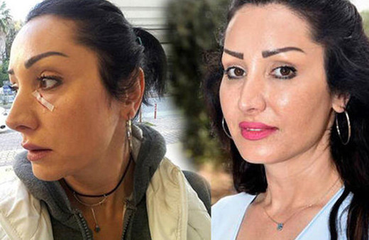 'Patatesi değiştir' dedi garson dehşet saçtı!