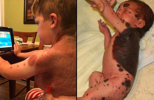 Bu şekilde doğdu! Doktor gerçeği açıkladı herkes şaşırdı