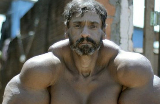 Herkes onu böyle tanıdı ama eski hali inanılmaz!