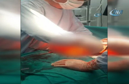 Kanındaki kist böyle çıkarıldı! '9 aylık hamile gibiydi'