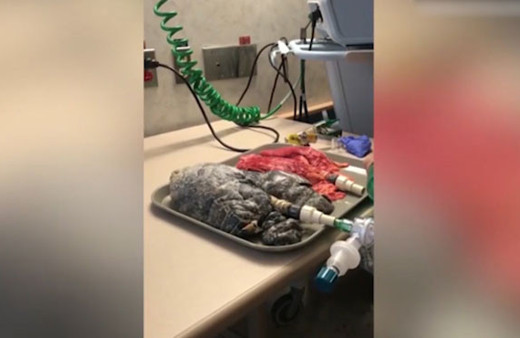 Şoke eden video! 20 yıl boyunca sigara içen insanın akciğeri...