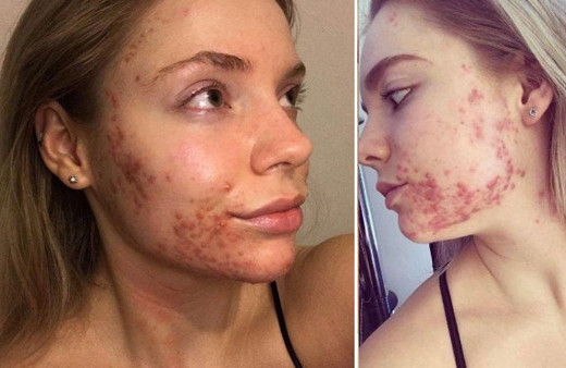 Hayatı kabusa dönmüştü! Keşfettiği besinle yeniden doğdu