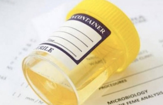 Oruçluyken idrar tahlili yaptırmak orucu bozar mı Diyanet noktayı koydu